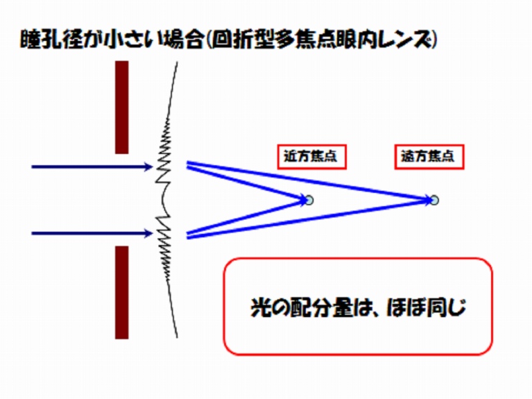 回折型