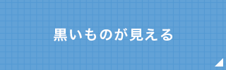 黒いものが見える