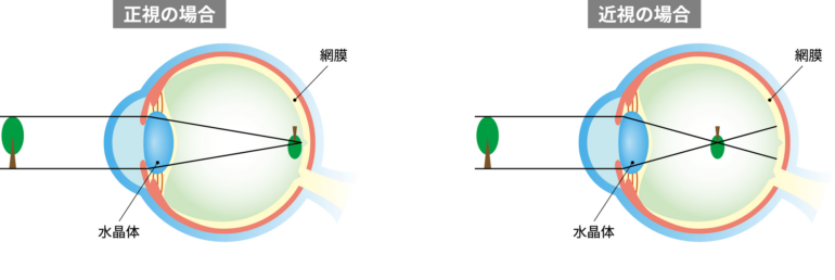 仕組み